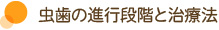 虫歯の進行段階と治療法