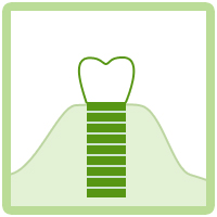 人工歯装着のイメージ画像